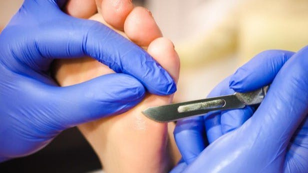 voetbehandeling-in-spa-salon-medische-pedicureprocedure-met-speciaal-instrument-met-meshouder-professionele-pedicure-met-dieffenbach-scalpel_511044-1552
